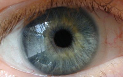 Vision